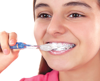 Woman brushing teeth with braces