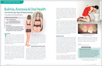 An article on bulimia, anorexia and oral health from Dear Doctor magazine
