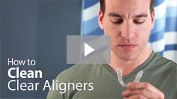 Cleaning clear aligners video