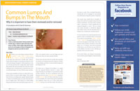 Article on common lumps and bumps in the mouth from Dear Doctor magazine