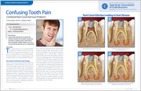 An article on confusing tooth pain from Dear Doctor magazine