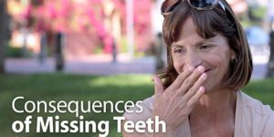 Woman Covering Mouth with hand due to missing teeth
