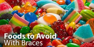 gummes, candies and foods to avoid with braces