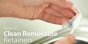Cleaning Removable Retainers