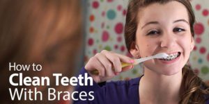 Teenage girl cleaning teeth with braces