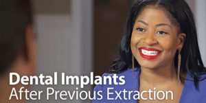 Woman Smiling after dental implant