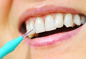 Interdental cleaning
