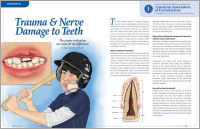 An article on trauma and nerve damage to teeth from Dear Doctor magazine