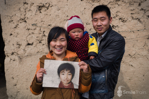 Family Picture with the Mother Holding a Picture of her son with Cleft Palate