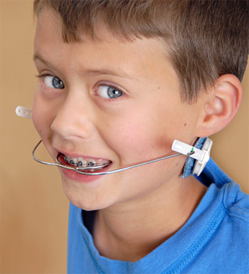 Child wearing orthodontic headger