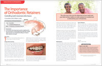 Article on importance of orthodontic retainers from Dear Doctor magazine