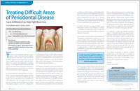 Article on treating difficult areas of periodontal disease from Dear Doctor magazine