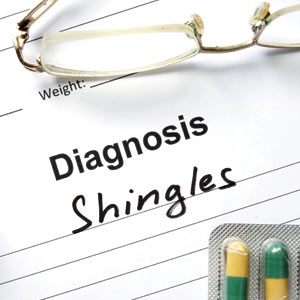 Diagnosis Shingles