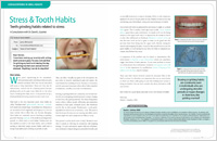 Stress and Tooth Habits Topic Dear Doctor