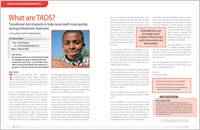 Article on Temporary Anchorage Devices (TADs) from Dear Doctor magazine