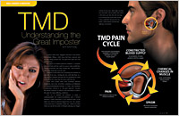 TMD Pain Cycle Article from Dear Doctor