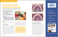 Article on tooth removal for orthodontic reasons from Dear Doctor magazine