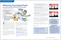 An article on whitening traumatized teeth from Dear Doctor magazine