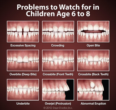 Orthodontic problems in children
