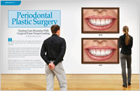 periodontal-plastic-surgery-dear-doctor